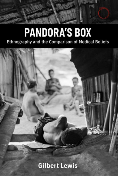 Pandora's Box