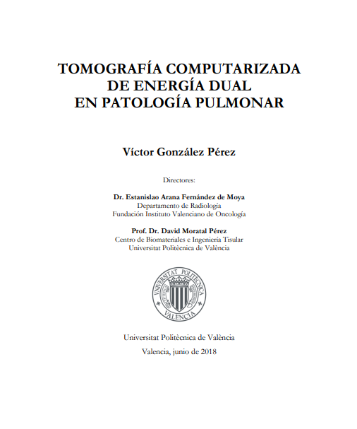 Tomografía computerizada de doble energía en patología pulmonar