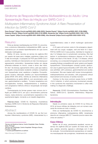 Síndrome de Resposta Inflamatória Multissistémica do Adulto: Uma Apresentação Rara da Infeção por SARS-CoV-2