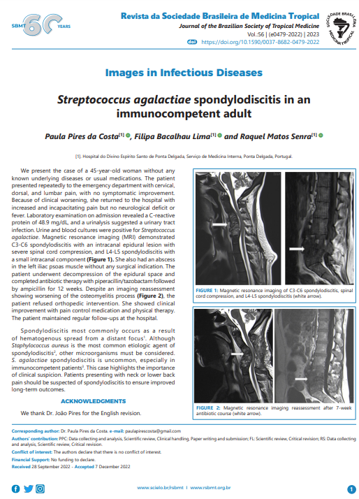 Streptococcus agalactiae spondylodiscitis in an immunocompetent adult