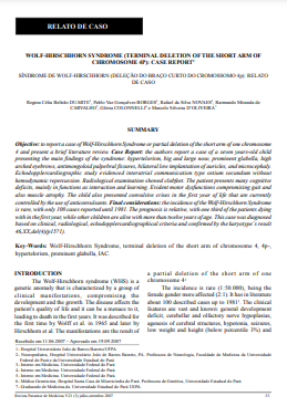 Síndrome de Wolf-Hirschhorn (deleção do braço curto do cromossomo 4p): Relato de caso
