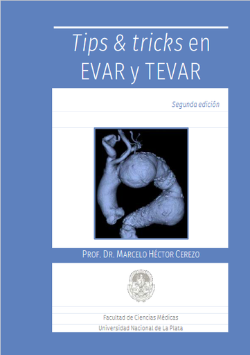 Tips &amp; tricks en EVAR y TEVAR