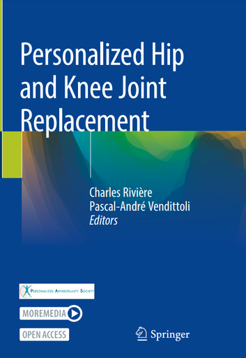 Personalized Hip and Knee Joint Replacement