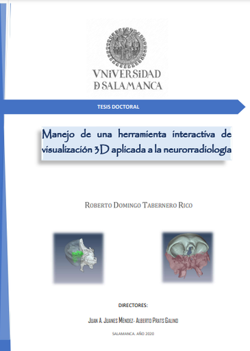 Manejo de una herramienta interactiva de visualización 3D aplicada a la neurorradiología