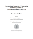 Tomografía computerizada de doble energía en patología pulmonar