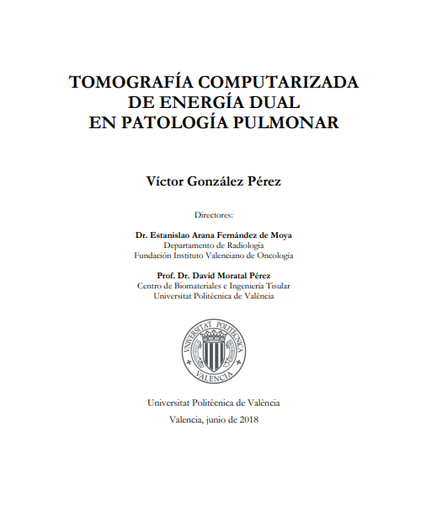 Tomografía computerizada de doble energía en patología pulmonar