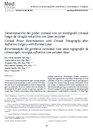Determinación del poder corneal con un tomógrafo corneal luego de cirugía refractiva con láser excimer