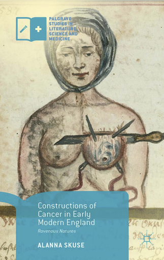 Constructions of Cancer in Early Modern England