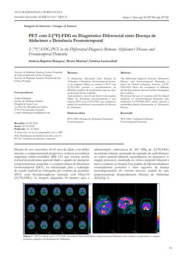PET com 2-[18F]-FDG no Diagnóstico Diferencial entre Doença de Alzheimer e Demência Frontotemporal
