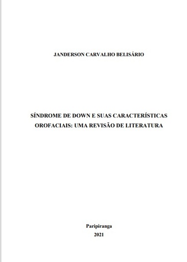 Síndrome de Down e suas características orofaciais: Uma revisão de literatura