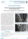 Streptococcus agalactiae spondylodiscitis in an immunocompetent adult