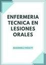 ENFERMERIA TECNICA EN LESIONES ORALES